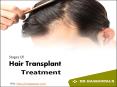 Hair Transplant Surgery Clinic in Gurgaon - Dr. RajaGopal's Clinic. PowerPoint PPT Presentation