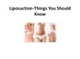 Liposuction-Things You Should Know PowerPoint PPT Presentation