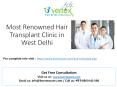Most renowned hair transplant clinic in west delhi PowerPoint PPT Presentation
