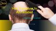 Hair Transplant In Ahmedabad PowerPoint PPT Presentation