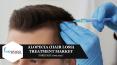 GLOBAL ALOPECIA (HAIR LOSS) TREATMENT MARKET FORECAST 2019-2027 PowerPoint PPT Presentation