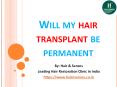 Will My Hair Transplant Be Permanent PowerPoint PPT Presentation