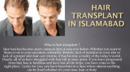 Hair transplant in Islamabad (2)