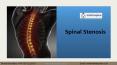 Spinal Stenosis | Dr Jwalant S Mehta PowerPoint PPT Presentation