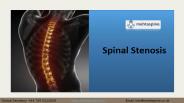 Spinal Stenosis | Dr Jwalant S Mehta