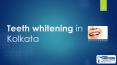 Teeth Whitening in Kolkata PowerPoint PPT Presentation