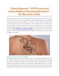 Tattoo Removal – Will Picosecond Lasers Replace Nanosecond Lasers? PowerPoint PPT Presentation
