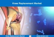 Knee Replacement Market Outlook
