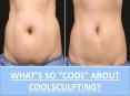 WHAT’S SO “COOL” ABOUT COOLSCULPTING? PowerPoint PPT Presentation