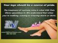 USA Vein Clinics PowerPoint PPT Presentation