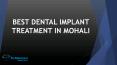 Best Dental Implant Treatment in Mohali PowerPoint PPT Presentation