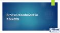 Braces Treatment in kolkata (1) PowerPoint PPT Presentation