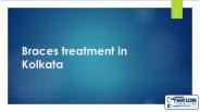 Braces Treatment in kolkata (1)