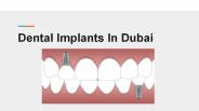 Dental Implants in Dubai