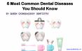 6 Most Common Dental Diseases You Should Know PowerPoint PPT Presentation