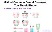 6 Most Common Dental Diseases You Should Know