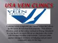 varicose vein treatments PowerPoint PPT Presentation