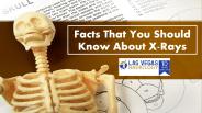 Facts That You Should Know About X-Rays