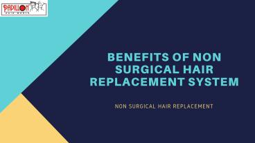 Benefits of Non Surgical Hair Replacement System