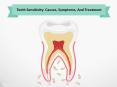 Teeth Sensitivity: Causes, Symptoms, And Treatment PowerPoint PPT Presentation