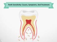 Teeth Sensitivity: Causes, Symptoms, And Treatment