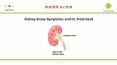 Kidney stone symptoms and its treatment PowerPoint PPT Presentation
