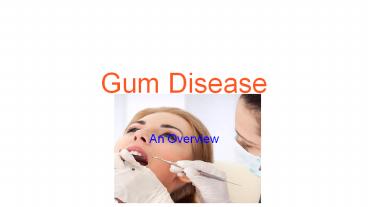 Gum disease - an overview