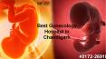 Best Gynecology Hospital In Chandigarh PowerPoint PPT Presentation