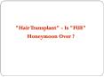 Best Hair transplant in Hyderabad - Dr Y V Rao Clinics PowerPoint PPT Presentation