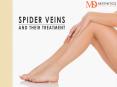 High-Quality Spider Vein Treatment Parker Co | Autumn Stone MD Aesthetics PowerPoint PPT Presentation