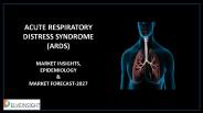 Acute Respiratory Distress Syndrome Market