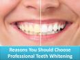 Reasons You Should Choose Professional Teeth Whitening PowerPoint PPT Presentation