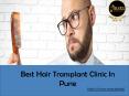 Best Hair Transplant Clinic In Pune PowerPoint PPT Presentation