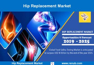 Hip Replacement Market Growth