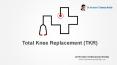 Total Knee Replacement (TKR) by Dr. Neelam V. Ramana Reddy (1) PowerPoint PPT Presentation