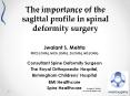 Importance of the sagittal profile in spinal deformity surgery PowerPoint PPT Presentation