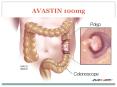 Avastin 100mg - Anticancer drugs | view uses, side effects and price | MHP PowerPoint PPT Presentation