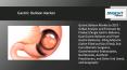 Gastric Balloon Market to Reach US$ 152.1 Mn in 2027 PowerPoint PPT Presentation