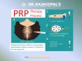 PRP Therapy Along With Hair Transplant Surgery - Dr. RajaGopal's Clinic. PowerPoint PPT Presentation