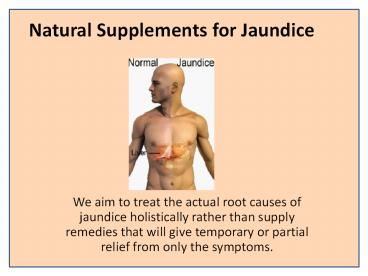 jaundice capsule hashmi