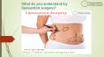 What  do you understand by liposuction surgery PowerPoint PPT Presentation