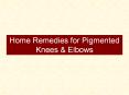 Home Remedies for Pigmented Knees & Elbows PowerPoint PPT Presentation