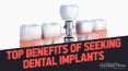 Top Benefits of Seeking Dental Implants PowerPoint PPT Presentation
