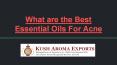 Best Essential Oils for Skin Acne or Acne Scars PowerPoint PPT Presentation