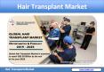 Hair Transplant Market - Global Industry Trends, Forecast 2019-2025 PowerPoint PPT Presentation