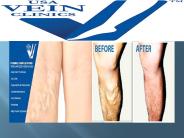 best vein center