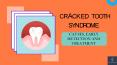 Cracked Tooth Syndrome: Causes, Early Detection and Treatment PowerPoint PPT Presentation