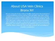 varicose vein treatments (2)
