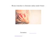 ब्रेस्ट के नीचे होने वाले रैशेज को खत्म करने के लिए घरेलू उपाय | Home remedies to eliminate rashes under breast