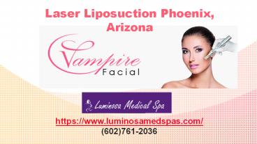 Laser Liposuction Phoenix, Arizona